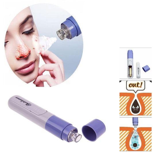 Electric Facial Pore Cleanser Face Blackhead Remover Skin Cleaner Tool 4756